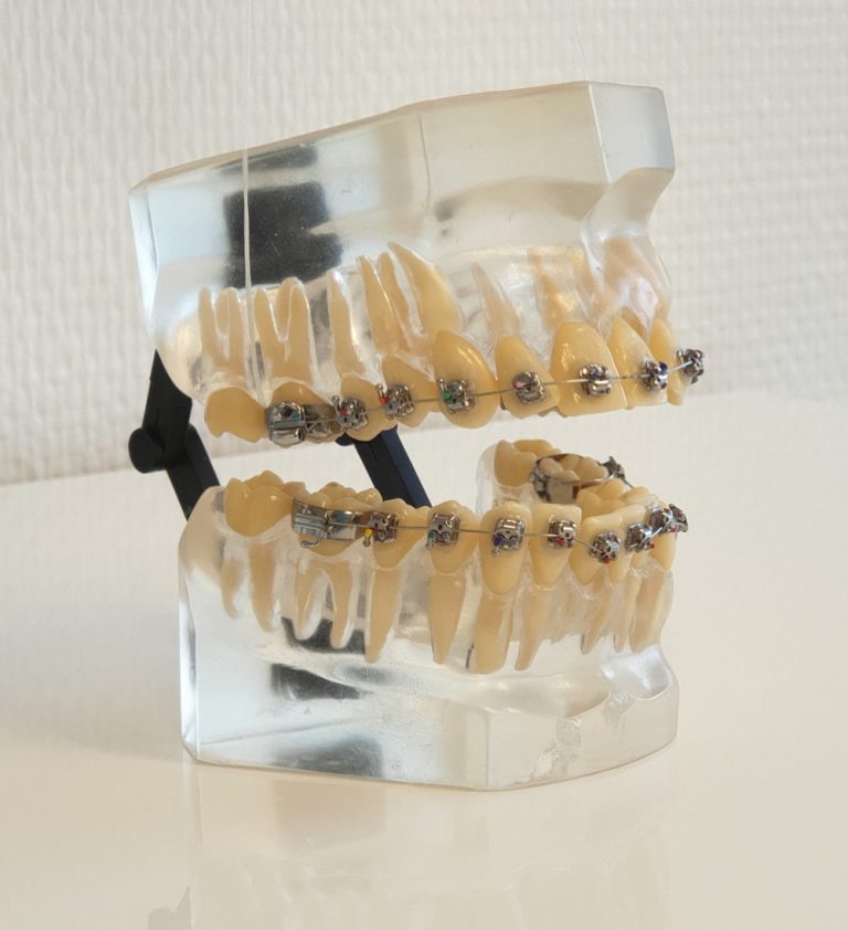 Orthodontie Winterswijk